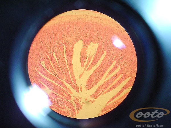 intestino delgaIII